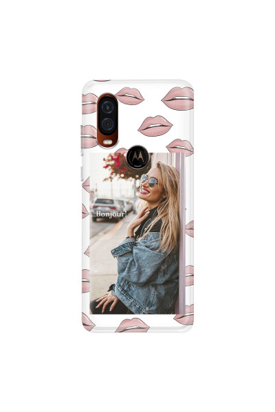 MOTOROLA by LENOVO - Moto One Vision - Soft Clear Case - Teenage Kiss Phone Case